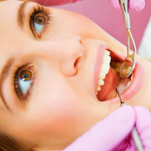 dental-cleaning-lady-with-mouth-wide-open