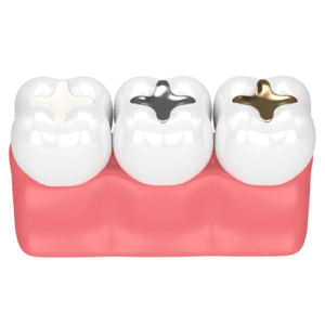 dental-implants-colors