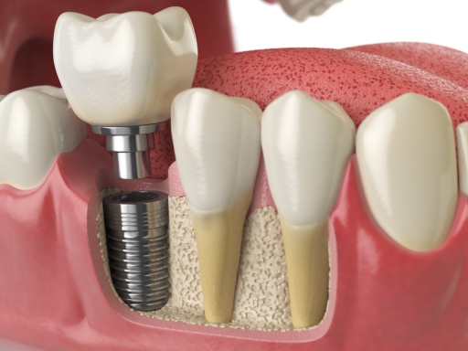 Anatomy-of-healthy-teeth-3D-illustration-in-human-dentura