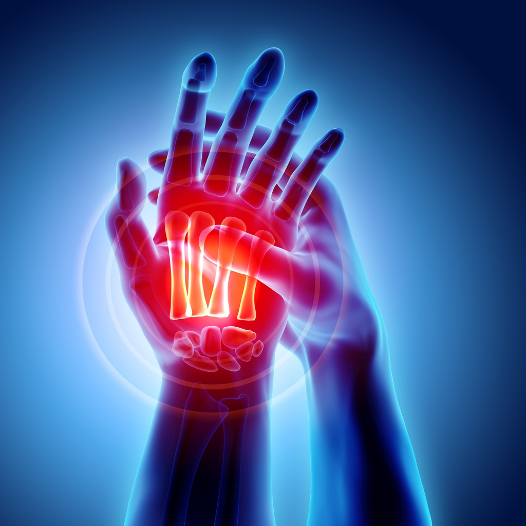 Arthritis pain-on-palm-x-ray